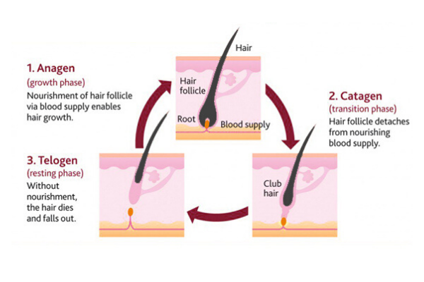 Laser Hair Removal